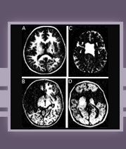 Neurology Specific Literature Search