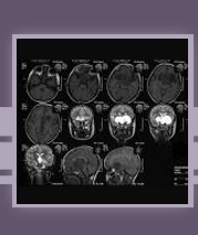 Neurology Specific Literature Search