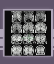 Neurology Specific Literature Search