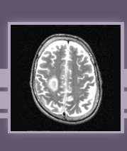 Neurology Specific Literature Search