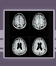 Neurology Specific Literature Search