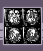 Neurology Specific Literature Search