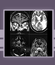 Neurology Specific Literature Search